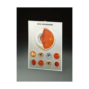 Eye Disorders 3D Lenticular Anatomical Chart  Industrial 