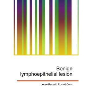  Benign lymphoepithelial lesion: Ronald Cohn Jesse Russell 