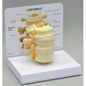 Lumbar Vertebrae 3 pc L2, L3 & L4 Anatomical Model  