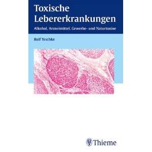 Toxische Lebererkrankungen. Alkohol, Arzneimittel, Gewerbe  und 